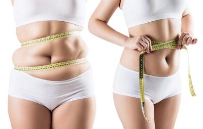 photo of Liposuction in Dubai