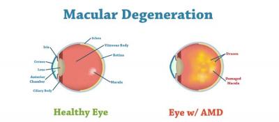 photo of Eye Stem Cell Center