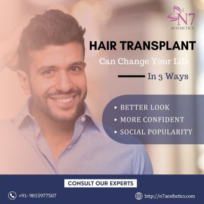 Hair Transplant in Mohali